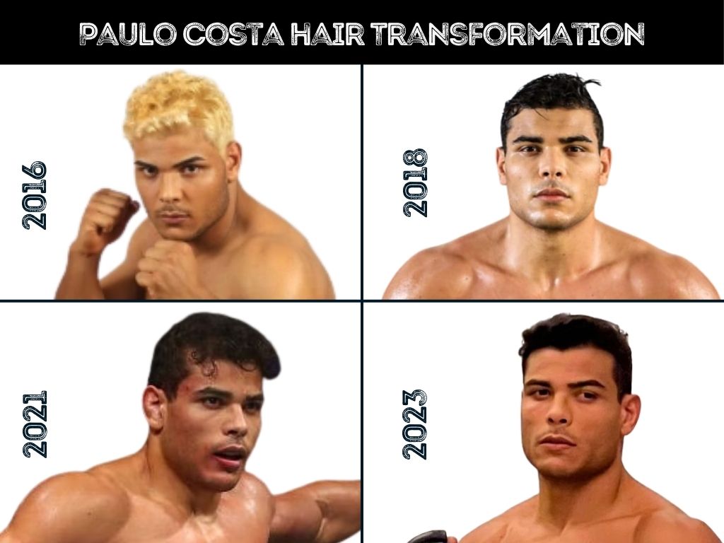 Paulo Costa Hair Transplant: Did He Really Get One?