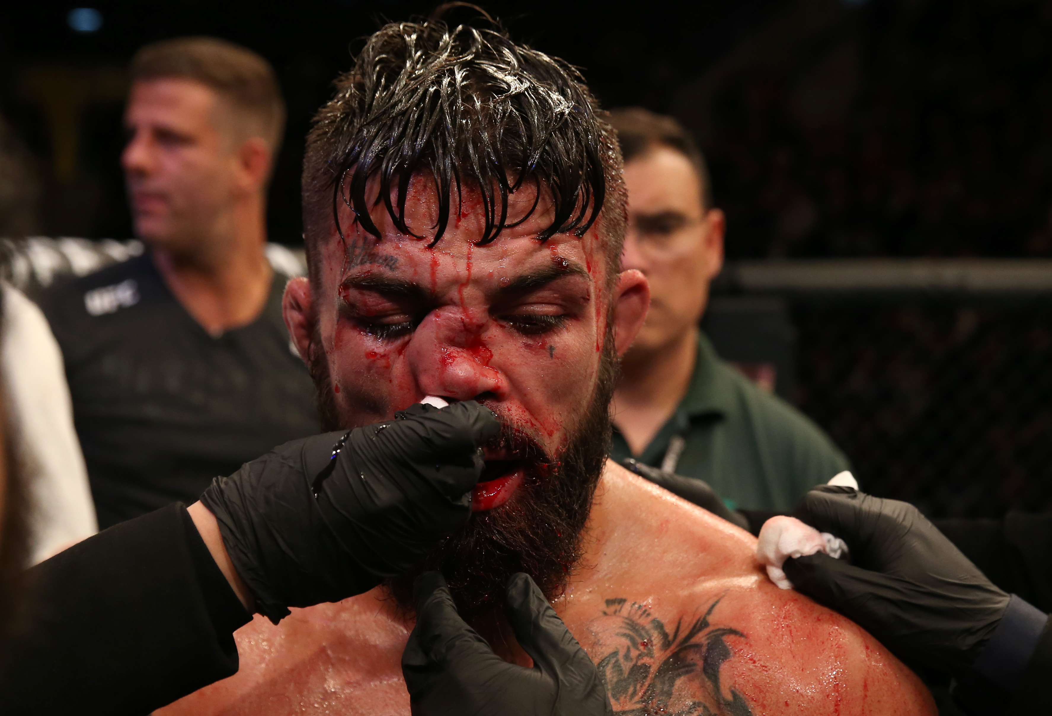 Mike Perrys Nose Injury: Everything You Need to Know About What Went Down.