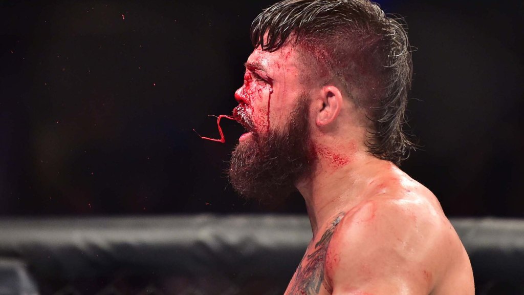 Mike Perrys Nose Injury: Everything You Need to Know About What Went Down.