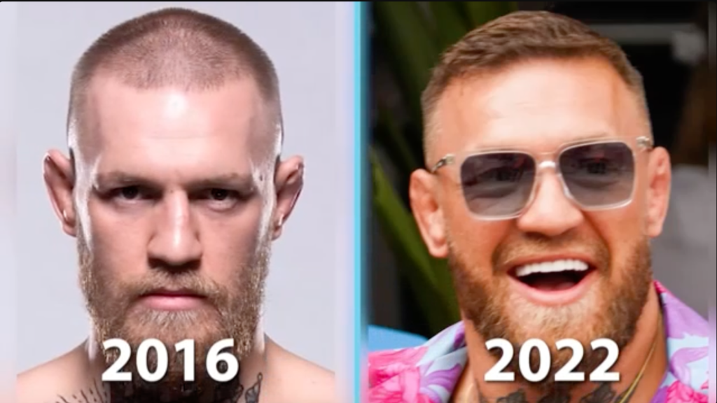 Mcgregor Hairline: Fans Ask, Is He Losing His Hair?