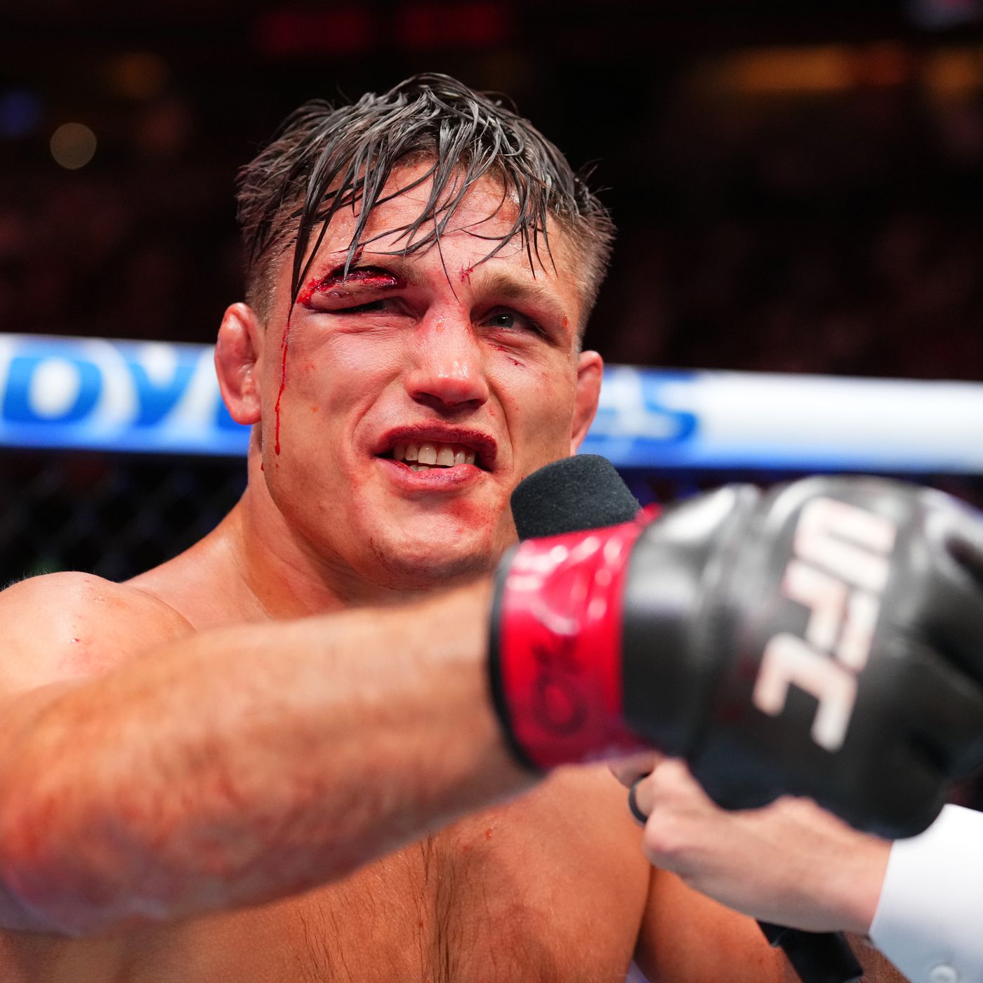 Drew Dober Eye Swollen Shut: Heres What We Know About the Severity of the Injury