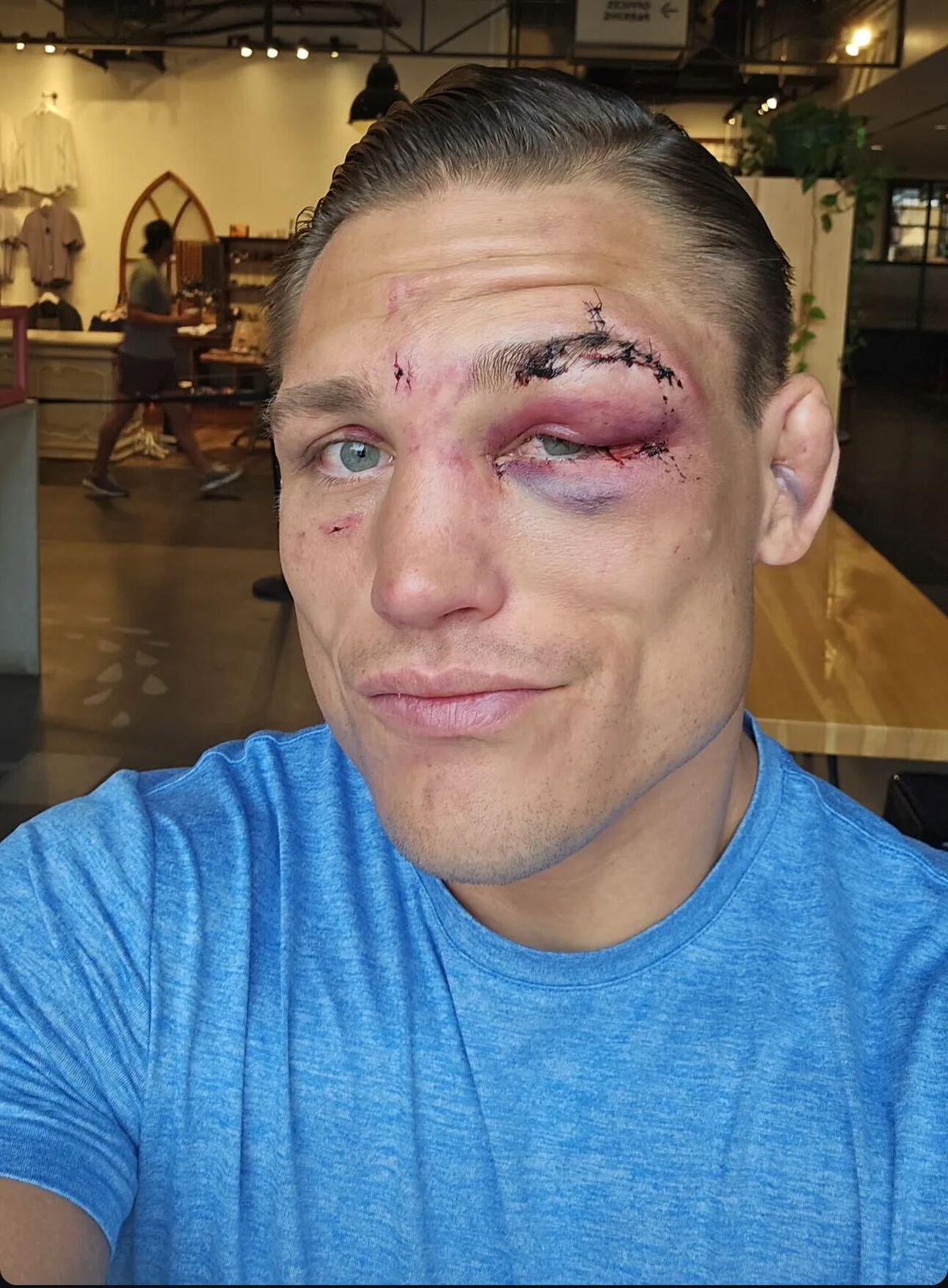 Drew Dober Eye Swollen Shut: Heres What We Know About the Severity of the Injury